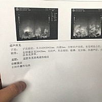 这个是什么意思