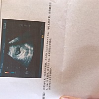 我该怎么办？医生说孩子死了，可是我身体没有任何不舒服，也经常恶心，我末次月经是10.4号，一般都是七...