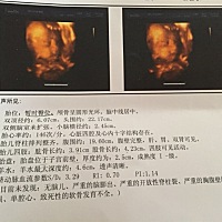 能看出来是男宝还是女宝吗好准备小衣服呢