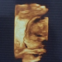 怀一胎的时候还是幸福的 期待的！ 人都是会变的  希望二胎早点出生 这样的日子 根本不想继续下去