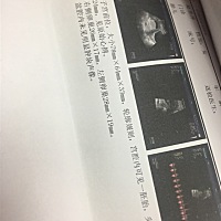 这个是男宝女宝啊，宝妈们会看吗