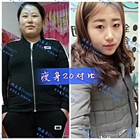 瘦了20斤