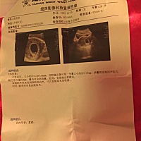 谁看得懂男宝还是女宝呢？