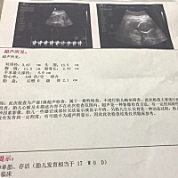 有经验的宝妈帮忙看看男孩女孩，谢谢