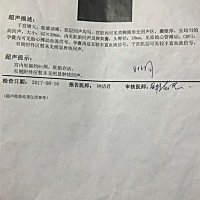 8周➕12周➕24周的B超单能看出男女吗？