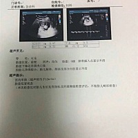 大家能帮我看看男宝女宝嘛，我都看不出来哪是头哪是脚
