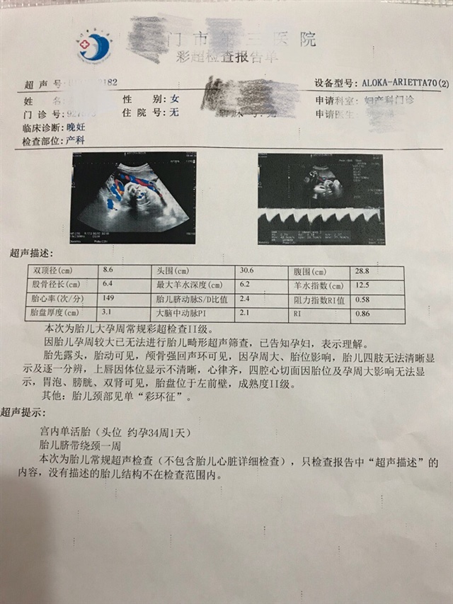 二宝是男孩还是女孩，😁