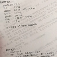 各位宝妈过来人，有能帮忙看看男孩女孩的吗。