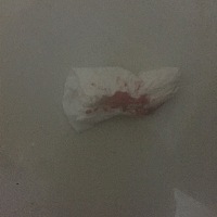 早上起来，上了个厕所，发现流血了，是月经来了，还是怎么了，