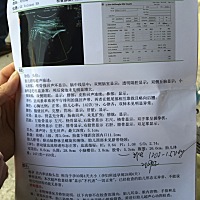 0-030周的四维单子亲们能帮我看看男女吗