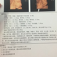 二胎了，怀孕已经6个月了，喜欢吃肥肉，不爱吃辣，不怎么孕吐，也不挑食，有没有会看的宝妈，看看是男宝...