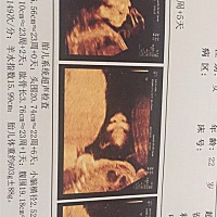 这个四维图  怎么不一样呢   宝宝样子都看不清    还有你们能帮看看是男孩还是女孩呀😄