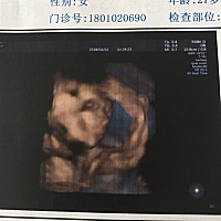 今天大排畸顺利通过了！小家伙特别淘，手一直也没拿下来，人家是个特别喜欢沉思的小公举呦！