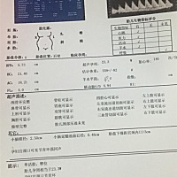 怀孕5个多月做的四维，有谁知道男孩还是女孩，医生说小脑还没长好，不知道是什么意思？