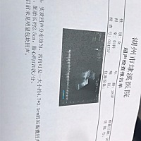 心跳是不是太高了 十周多