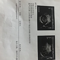 B超检查结果显示不能完全排除小结构的异常是什么意思？求解