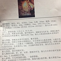 很期待宝宝的出生，但是却是很好奇，是男宝女宝，有会看的宝妈可以帮我看下么^_^