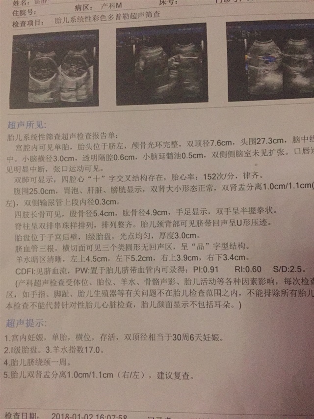 大家帮我看看，医生说宝宝肾不好，是男还是女孩子