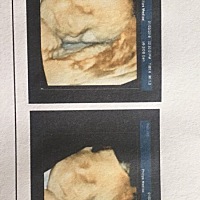 大家帮忙看一下、是男宝宝还是女宝宝？