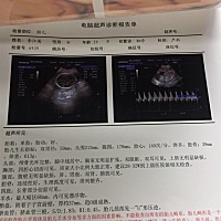 各位宝妈帮我看看是男宝还是女宝？