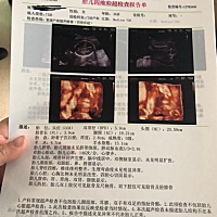 有会看的吗？这是穿裙子的还是穿裤子的？😁😁