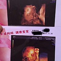 上面一张是大宝女孩  下面一张是二宝三个月检查的时候说是男孩  不知道准不准  看着两个长的像吗