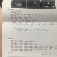 求解，现孕31周，昨天检查的B超结果，胎儿头颈间见“U”形脐带压迹及彩色血流环绕是什么意思？