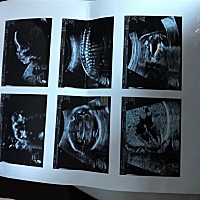 好奇是男孩还是女孩，请有经验的宝妈帮忙看一下，纯属好奇😊