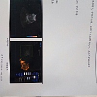 孕6周，从胎囊能看出男宝女宝吗？求懂的有经验的辣妈们给经验和结论