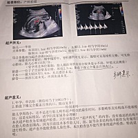 帮忙看看男孩女孩