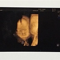 宝妈们，能看出来是男孩或女孩吗？很好奇