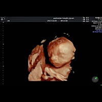 到底在肚里打嗝还是……肚子里面一跳一跳的，宁可他翻身跳舞，真心好涨，不舒服