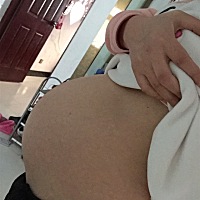 32w！女宝，男宝症状