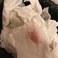 哎 好焦灼  怎么回事  前天打彩超都没有什么问题 肚子又不疼