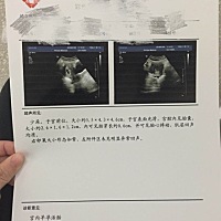 各位宝妈们帮看一下是男孩还是女孩☺️