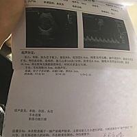 谁能帮我看下是男孩还是女孩？