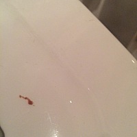 12月23日晚上例假结束，25号开始同房，基本隔一天一同房，昨天四号腰酸肚子胀痛，例假感特强，而且晚上...