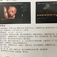 男女都喜欢，今天四维刚过