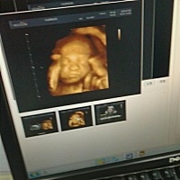 这是我家的宝宝、今天去给她还是他拍照片了、不知道是女儿还是儿子，有谁会看