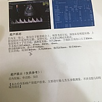 这个是今天查的  宝妈们能看出男宝女宝嘛  很好奇