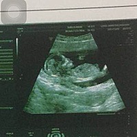 亲们能看出男宝女宝嘛？