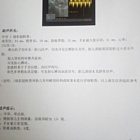 宝宝现在已经26周，现在要开始着手准备宝宝的东西了，我准备的都是女娃娃的颜色，我老公说让我怎么准备...