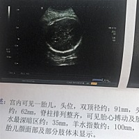 还有两个星期，帮忙看看男孩女孩