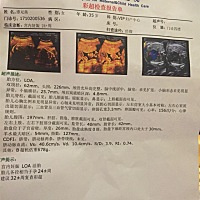 孕24周的四维彩超，帮我看下是男宝还是女宝，一胎是女儿8岁了，超级好，享了她好多福了，还想要个女儿，...