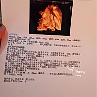 24周在县城做的四维，医生说宝宝心脏有强回声，25周在市里又做了四维，医生说正常。这样还需不需要去省...