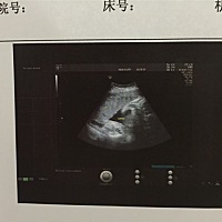 有看懂的帮我看下男孩女孩