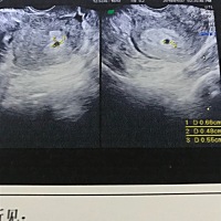 好小呀，能看出男女宝吗