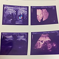 之前做的四维可以看出男宝女宝吗？