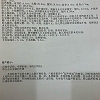 二胎宝宝。谁看懂男女？帮我看看😊