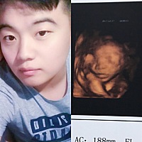 宝爸死活不准我去检查，说男宝女宝他都感谢，只要宝宝健健康康，我的好奇心满足了，哈哈！宝宝的五官像...